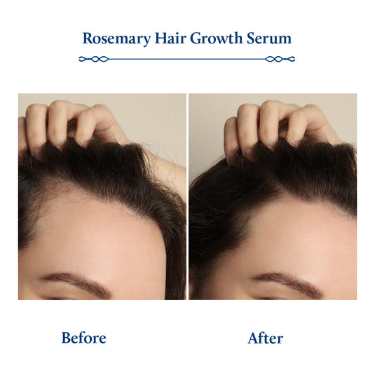 Before and After the use of Rosemary Hair Growth Serum