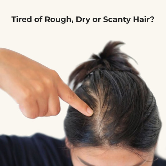 Hair Growth Oil - Potent Actives like Ceramides, Vitamin C & 16 Botanical Oils (Jaborandi, Gotu Kola & more) a mixture of champi with potent actives