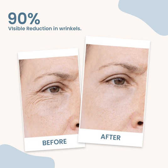 Earthraga HA+Retinol Night Cream with Niacinamide & Aquaxyl 50 gm