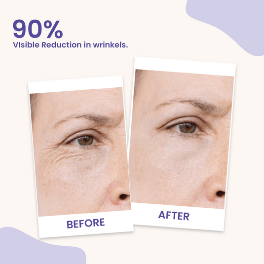 Earthraga HA + Retinol Advanced Night Cream with Squalane and Vitamin E 50 gm