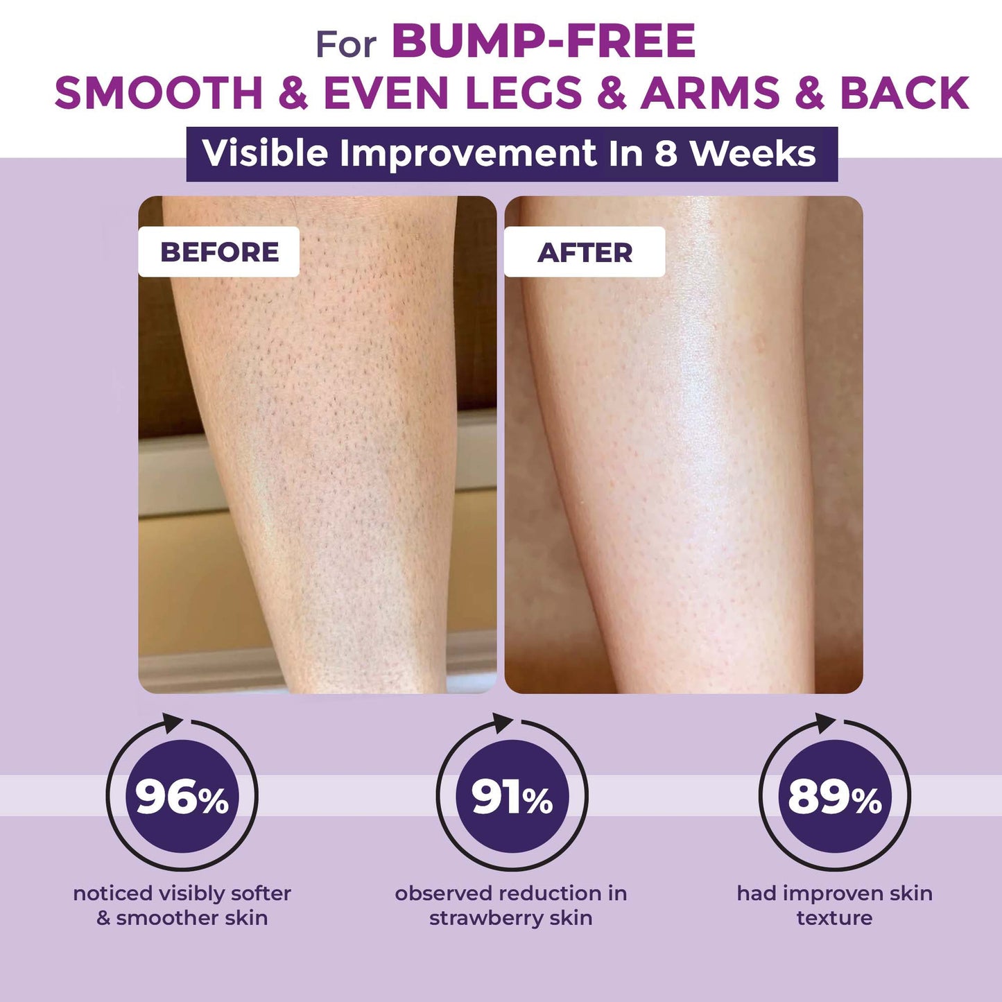 Bumps Erasing Body Scrub