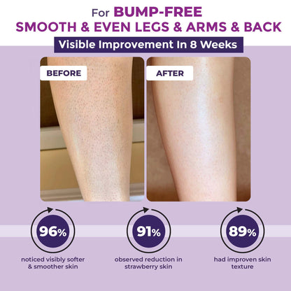 Bumps Erasing Body Scrub