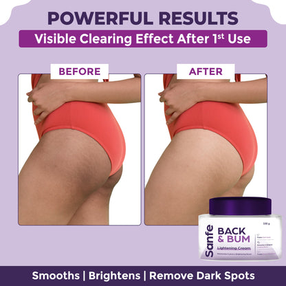 Back and Bum lightening Cream - 100gm