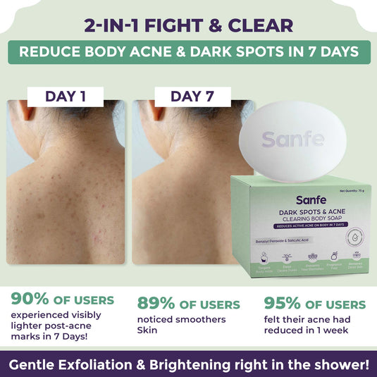 Sanfe Dark Spot Acne Clearing Soap