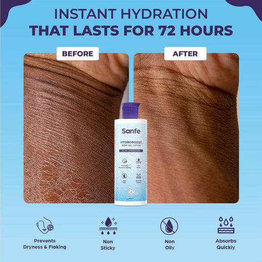 Hydroboost Body Gel Lotion