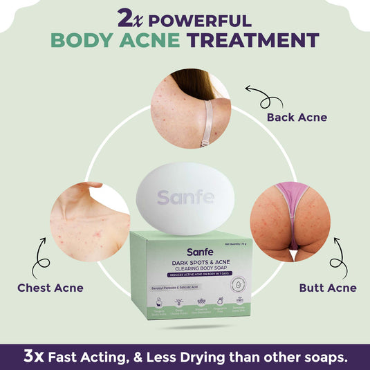 Dark Spots & Acne Clearing Body Soap