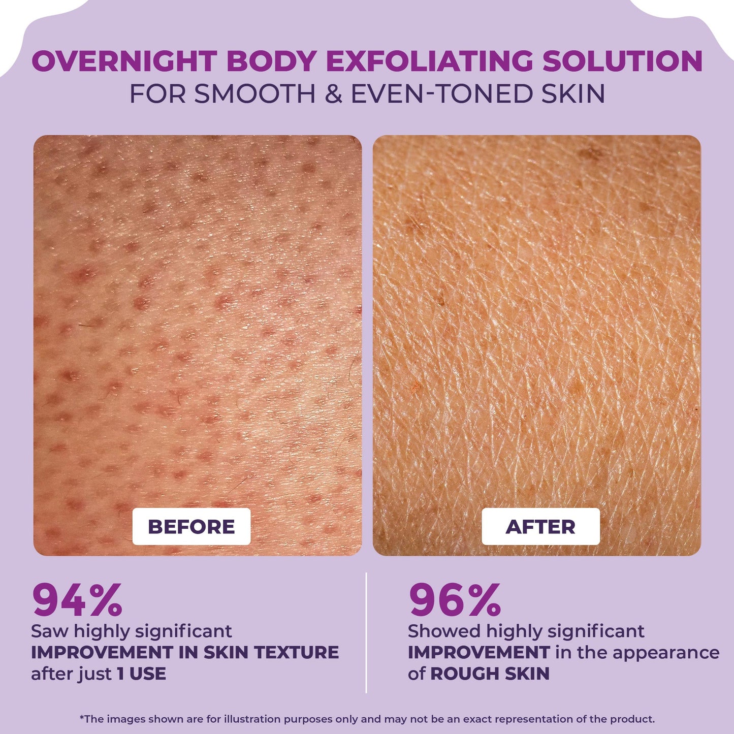 Clear & Confident Overnight Glow Body Cream for Face