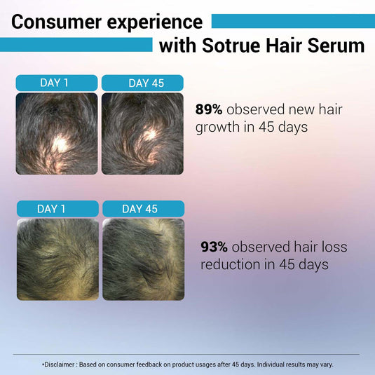 Hair Growth Serum - 12% Hair Growth Actives