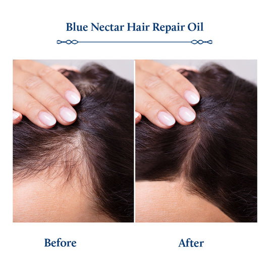 Hairfall treatment, Hair growth formula.