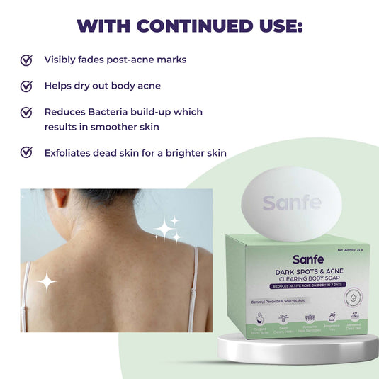 Sanfe Acne Clearing Soap