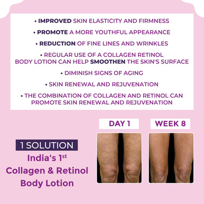 Sanfe Collagen Retinol Body Lotion - 200ml