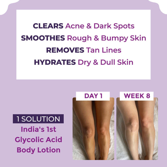 Glycolic Acid Body Lotion