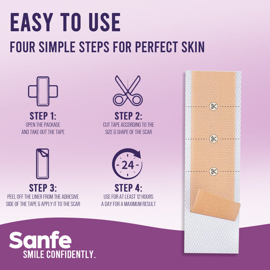 Sanfe Silicone Scar Sheet