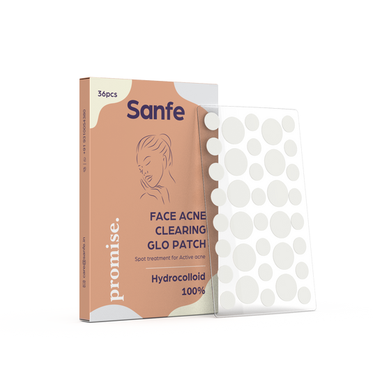 Sanfe Face Acne Glo Patch - Pack of 36