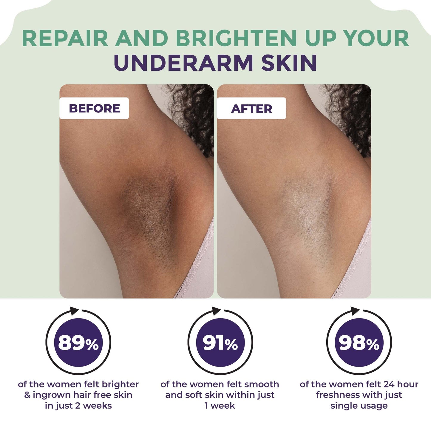 Underarm Lightening Roll On For Women