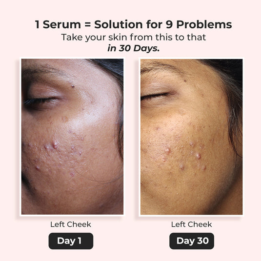 Treat My Skin barrier | A milky serum + moisturizer