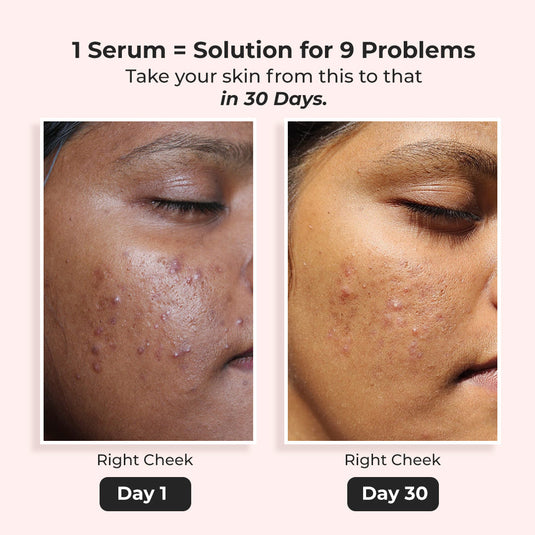 Treat My Skin barrier | A milky serum + moisturizer